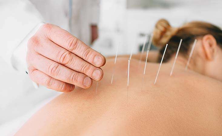 Acupuncture session with patient - What to Know About Acupuncture for Pancreatic Cancer Patients ...